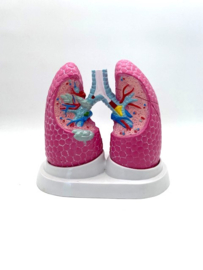 Anatomisch model van de longen met pathologieën