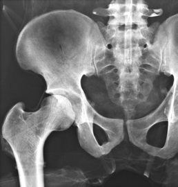 Erler Zimmer Transparant bekken voor training maken Röntgenfoto's