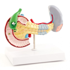 HEINE SCIENTIFIC Anatomisch model alvleesklier, milt en galblaas met ziektebeelden