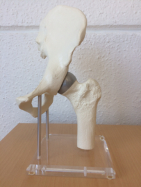 Anatomisch model Heup gewricht op transparante basis