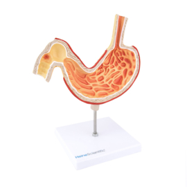 HEINE SCIENTIFIC Anatomisch model maag met zweren