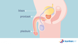 Afbeelding De plasbuis bij de man