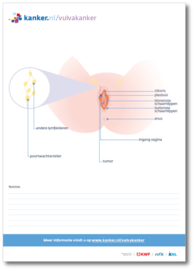 Tekenblok Vulvakanker