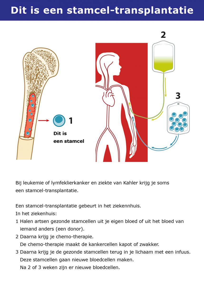 Praatkaart Stamcel-transplantatie