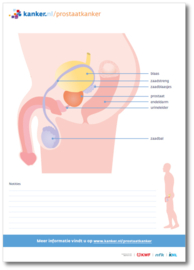 Tekenblok Prostaatkanker