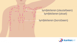 Afbeelding Lymfeklieren rondom de borst van de man