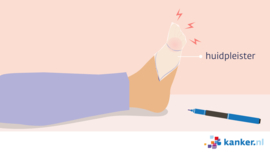 Afbeelding Qutenza huidpleister