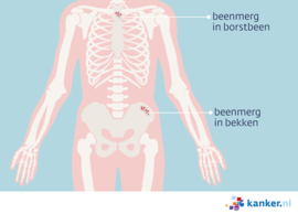 Afbeelding Beenmerg in het borstbeen en bekken