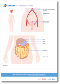Tekenblok Eierstokkanker