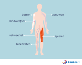 Wekedelentumoren/wekedelensarcomen