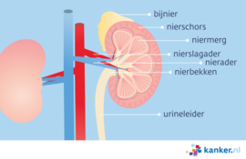 Nierkanker