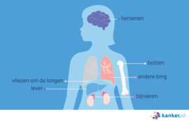 Afbeelding Uitzaaiingen van longkanker in andere organen
