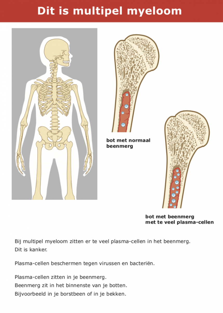 Praatkaart Multipel myeloom