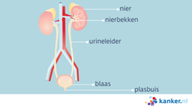 Hoge urinewegkanker