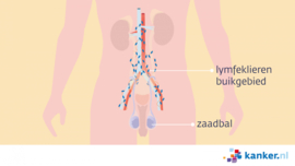 Afbeelding Lymfeklieren achter in de buik