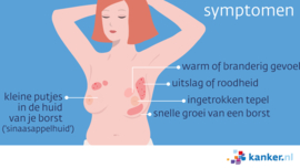 Afbeelding Inflammatoire borstkanker