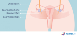 Afbeelding Baarmoederhalskanker steunweefsel