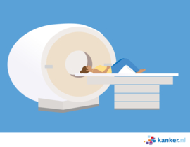 Afbeelding MRI-scan vrouw