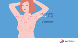 Afbeelding Lymfeklieren in het gebied rond de borsten