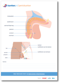 Tekenblok Peniskanker