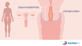 Afbeelding Baarmoederhalskanker opbouw baarmoederhals