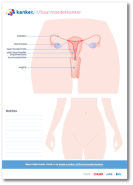 Tekenblok Baarmoederkanker